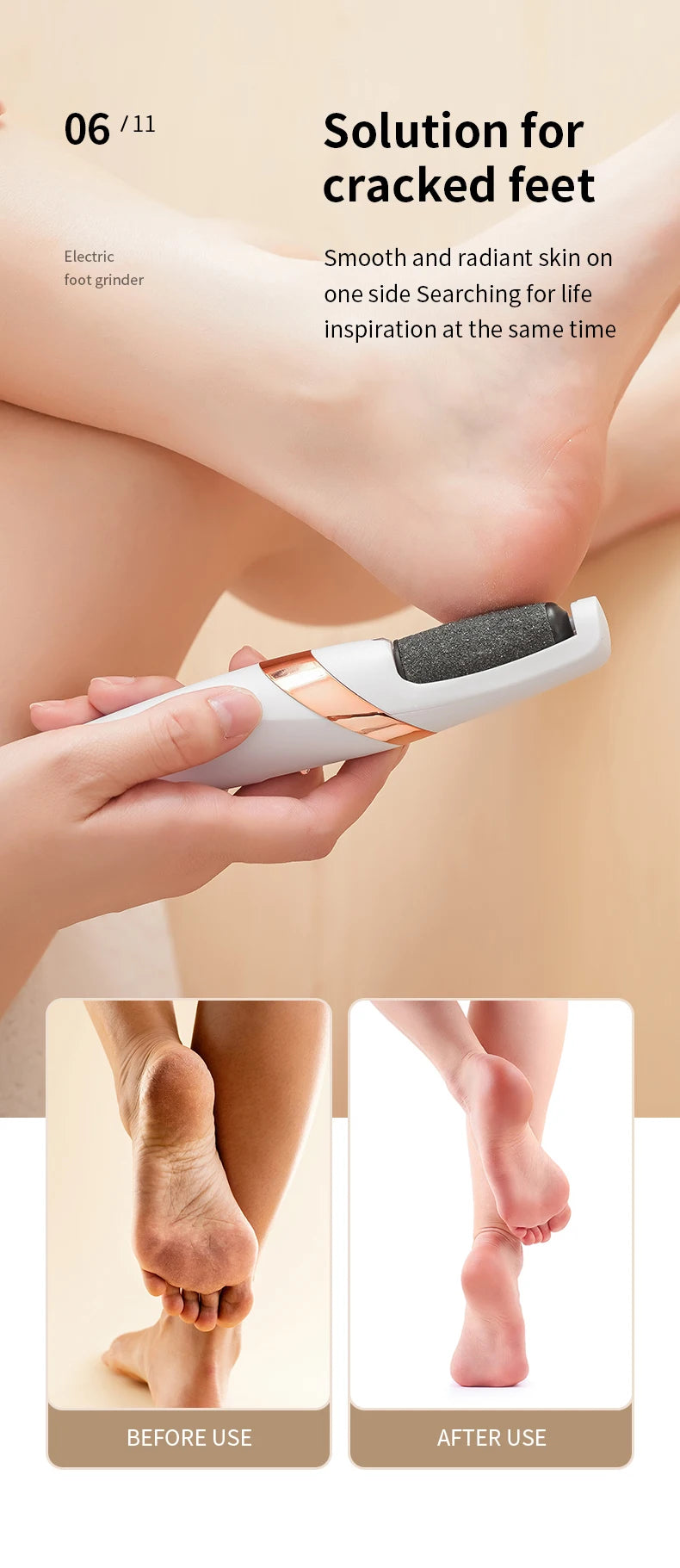 Handheld device for cracked feet with 'Before' and 'After' images showing skin improvement.