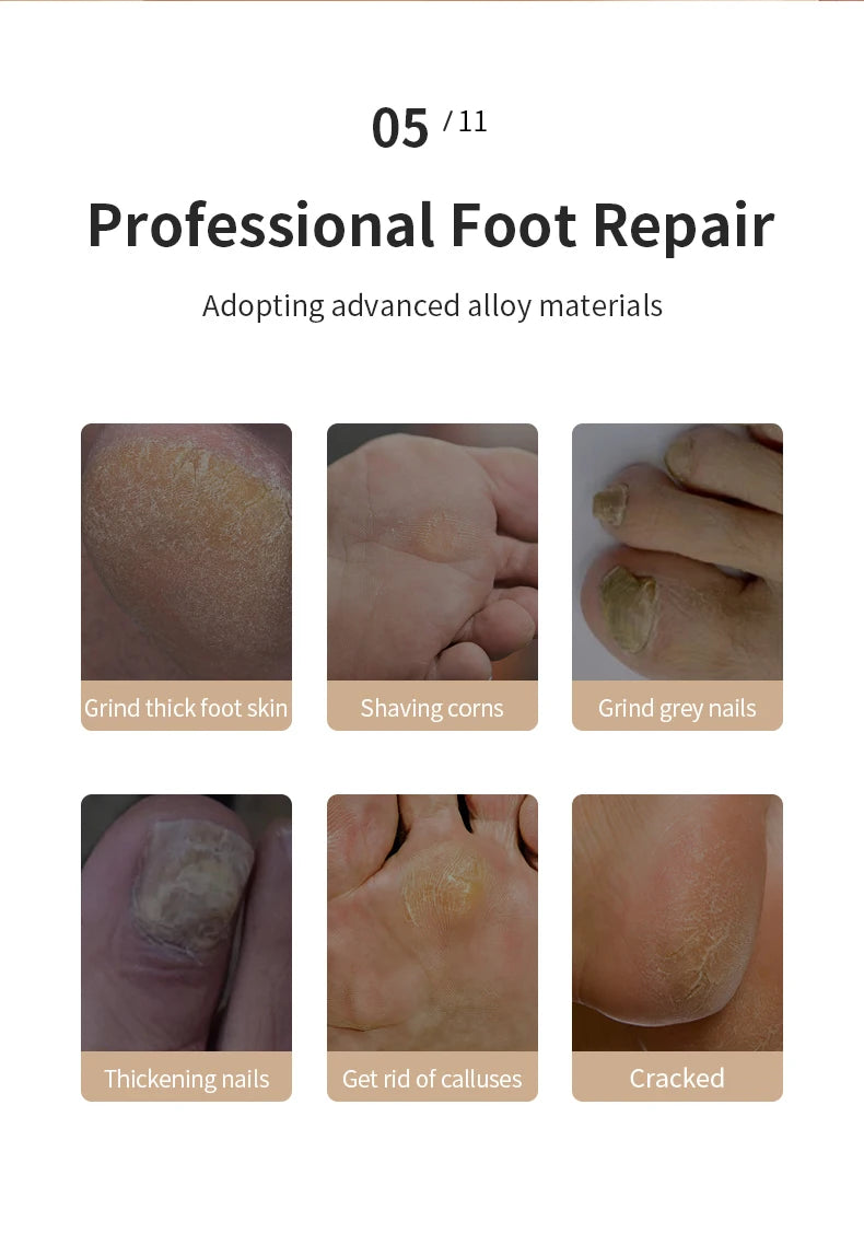 Steps of professional foot repair using advanced alloy materials on a white background.